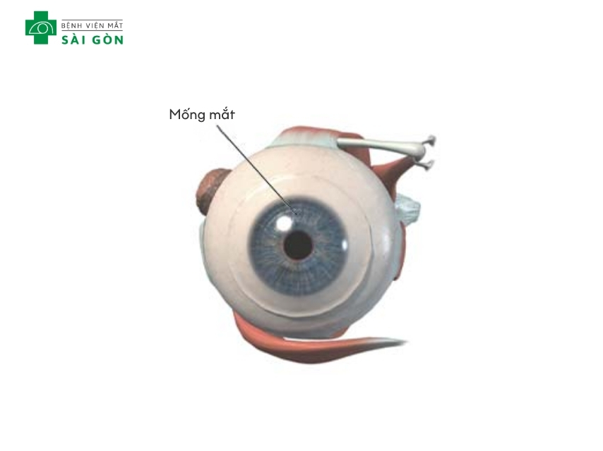 Mống mắt nằm phía trước giữa giác mạc và thủy tinh thể
