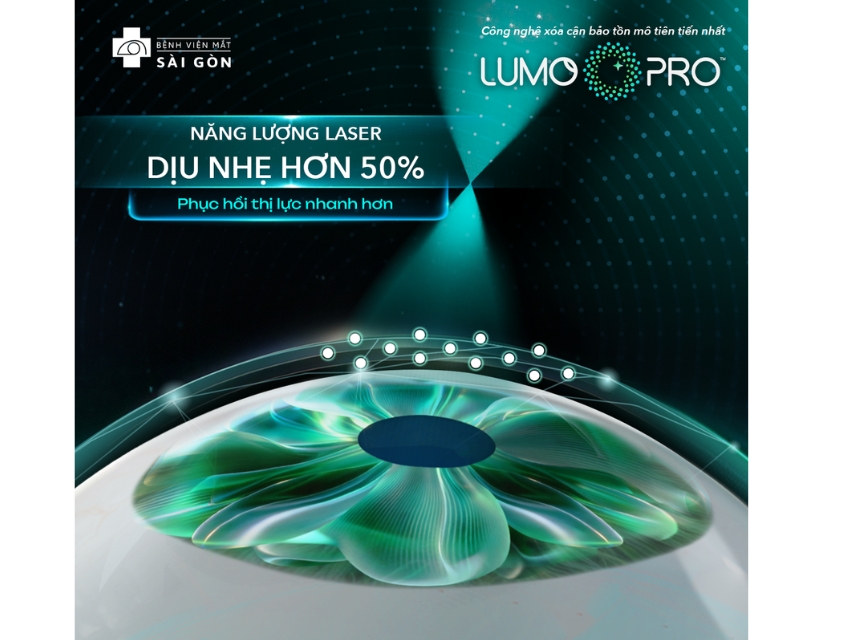Năng lượng laser thông minh, dịu nhẹ hơn 50%
