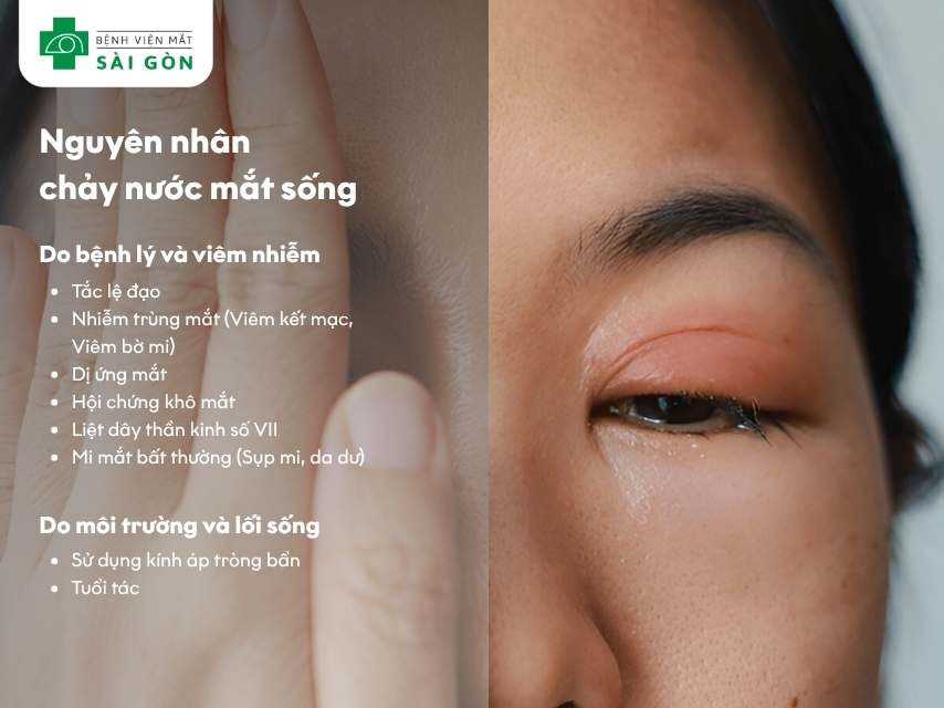 Các nguyên nhân gây chảy nước mắt sống