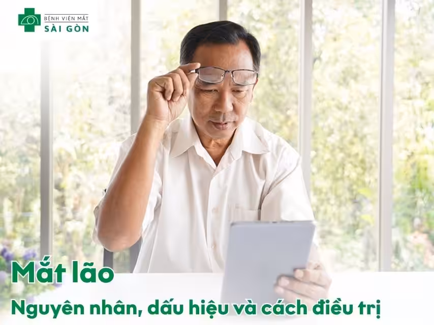 Mắt lão là gì