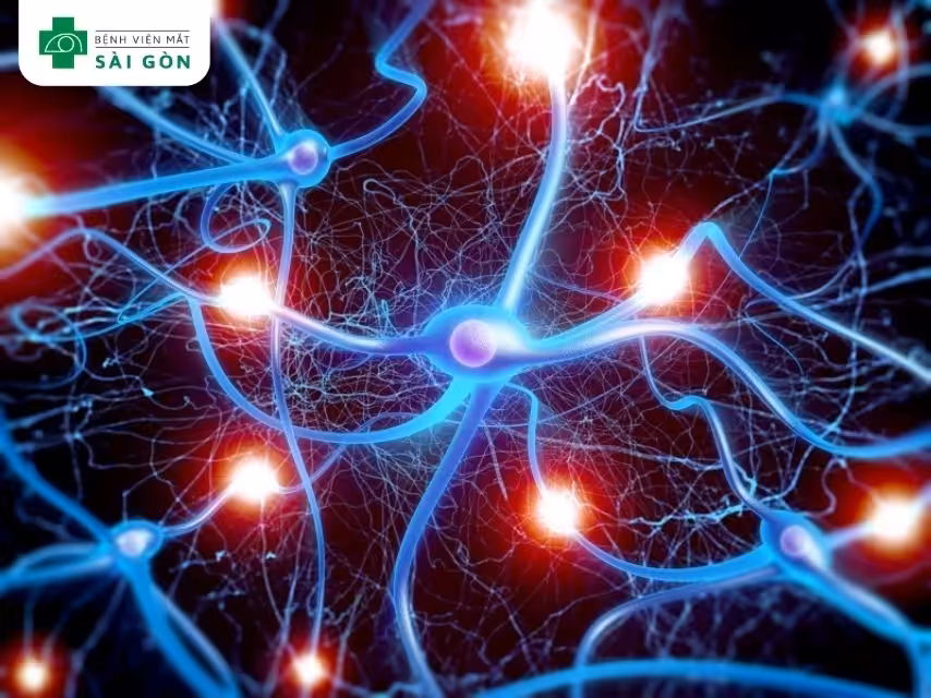 Nguyên nhân gây ra hội chứng Horner