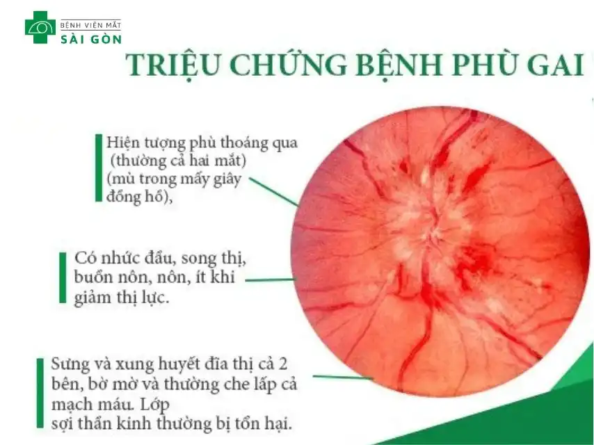Hậu quả trực tiếp của tình trạng tăng áp lực nội sọ