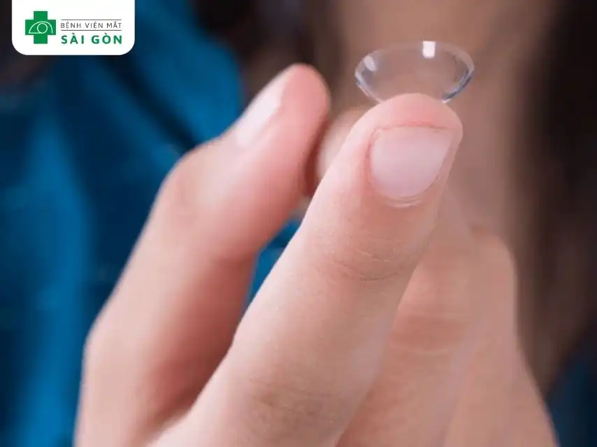 Đeo kính áp tròng quá lâu