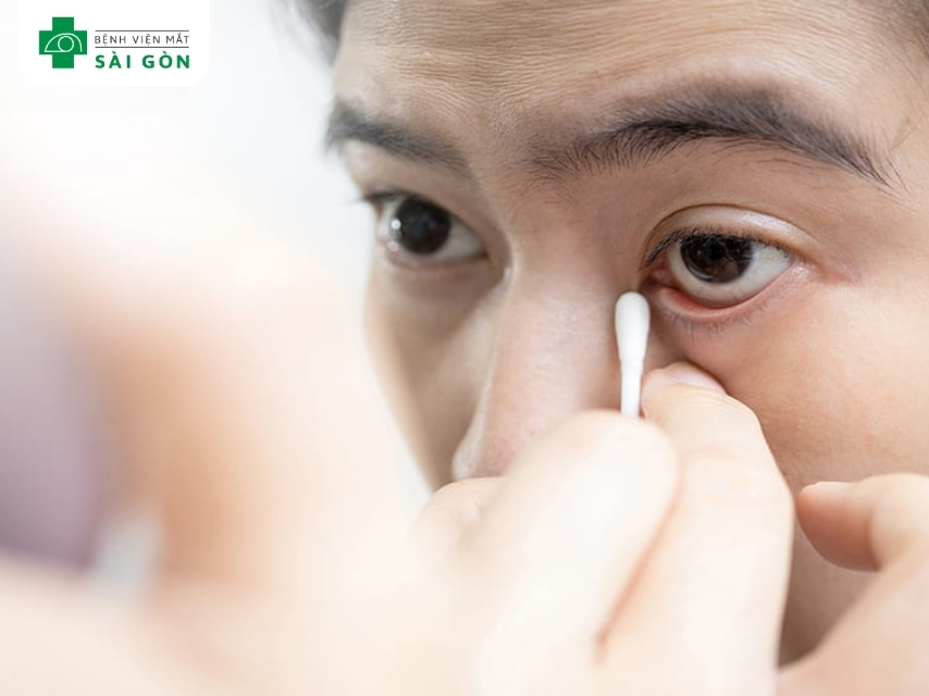 Dị vật trong mắt làm tổn thương hốc mắt