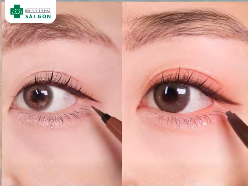 Nhận biết các kiểu mắt