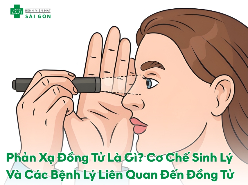 Cơ chế và các bệnh lý liên quan phản xạ đồng tử