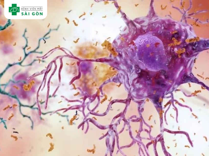 Omega 3 chống viêm mạnh mẽ, giảm viêm khớp.