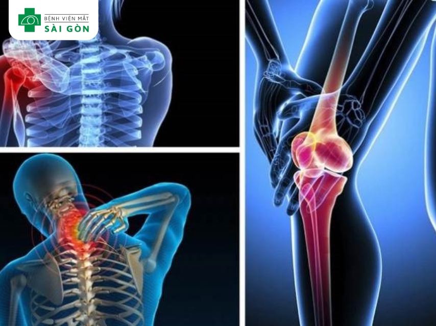 Omega 3 cải thiện sức khỏe xương khớp.