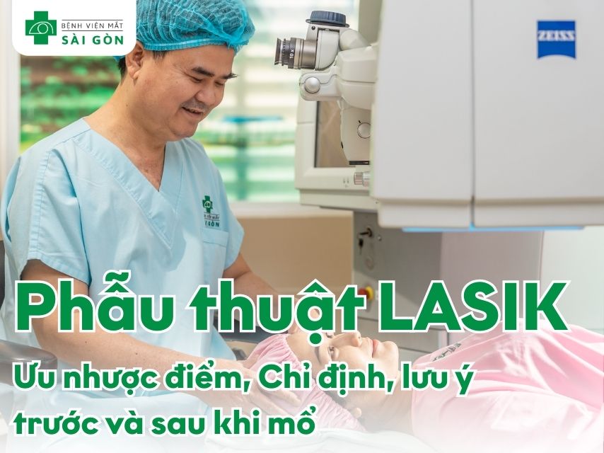 Phương pháp mổ cận lasik