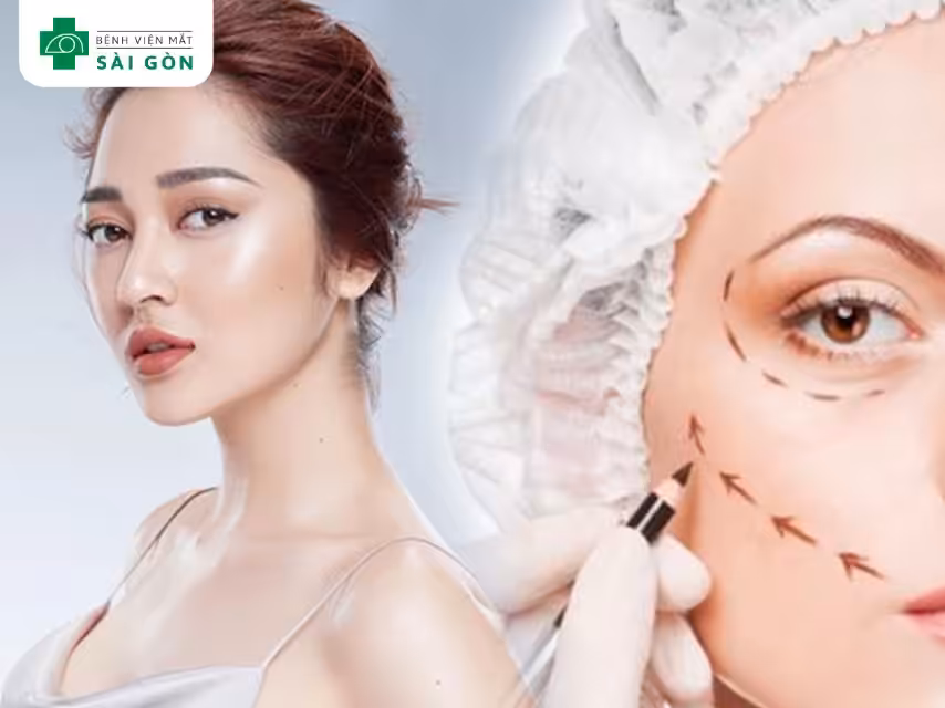 Phẫu thuật nâng mí