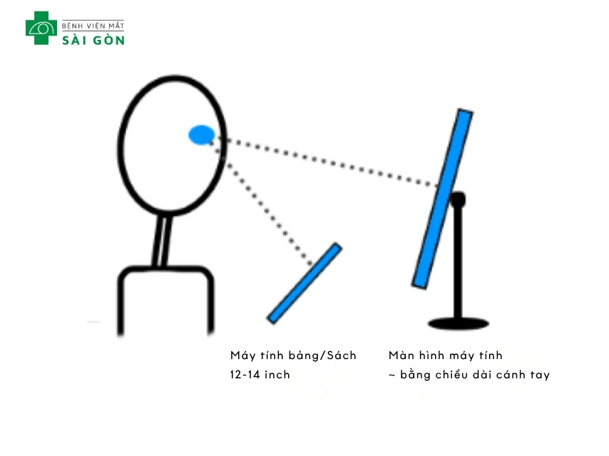 Cần quan sát, để ý phòng ngừa loạn thị trẻ em