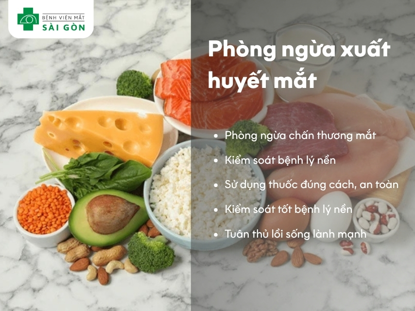 Cách phòng ngừa xuất huyết mắt