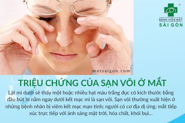 phòng ngừa sạn vôi ở mắt