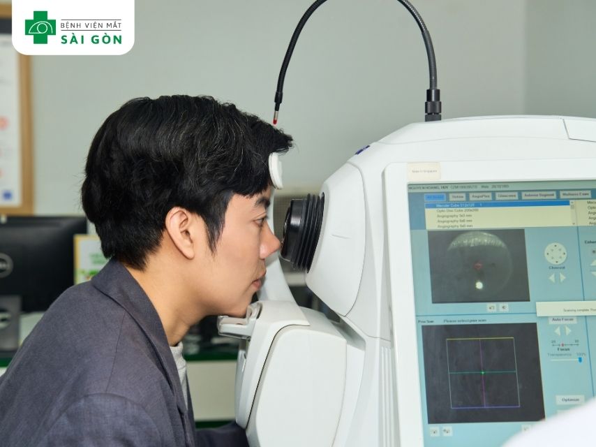 Phẫu thuật LASIK với SMILE Pro AI 4.0