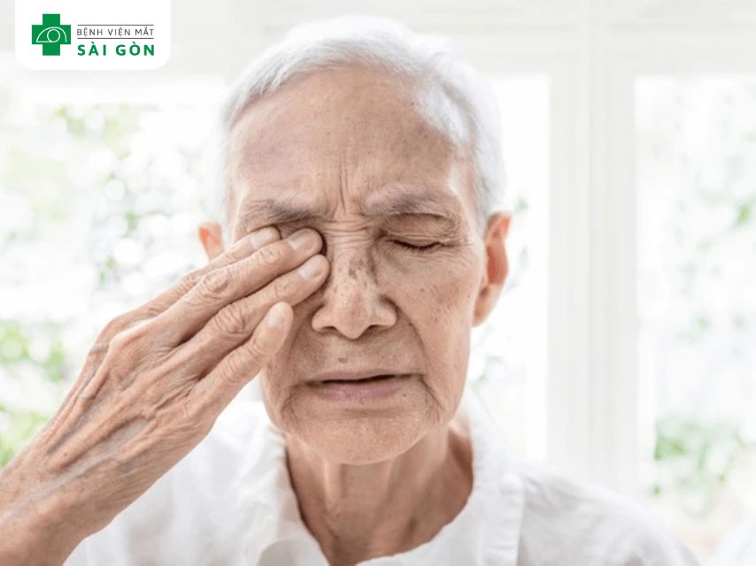 Dụi mắt làm triệu chứng nặng hơn