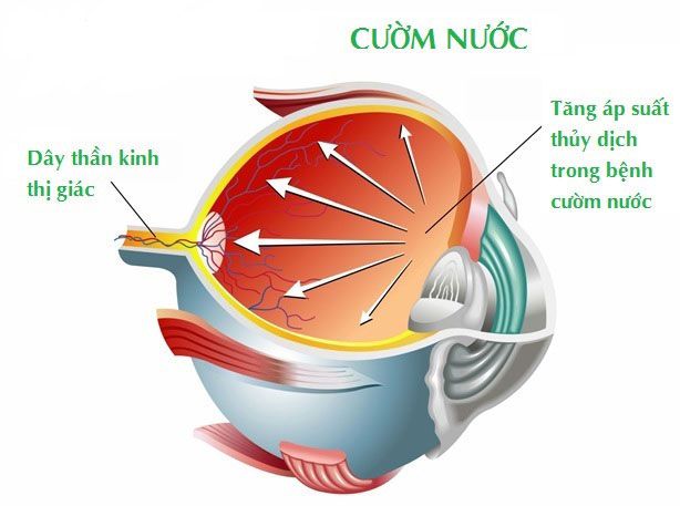 Tìm hiểu cườm nước là gì và cách sử dụng trong nông nghiệp hiện đại