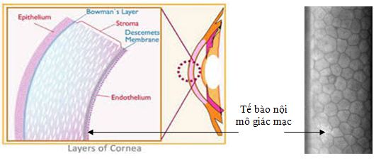 tế bào nội mô giác mạc