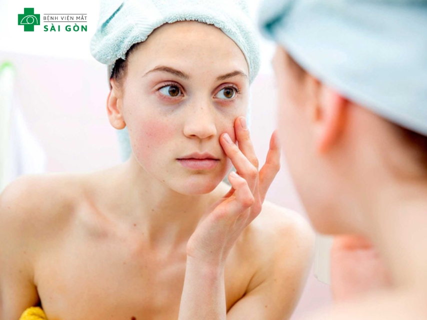 Mỹ phẩm không phù hợp gây thăm mắt