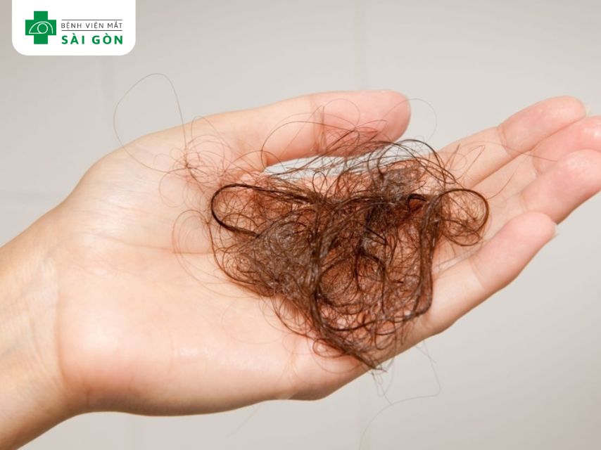 Thiếu B12 gây rụng tóc