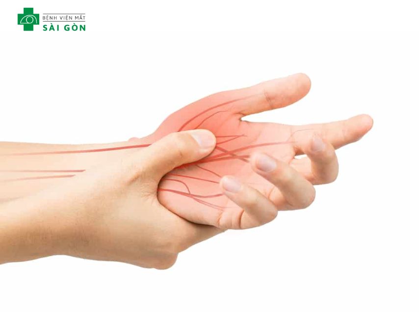 Thiếu B12 gây tổn thương thần kinh