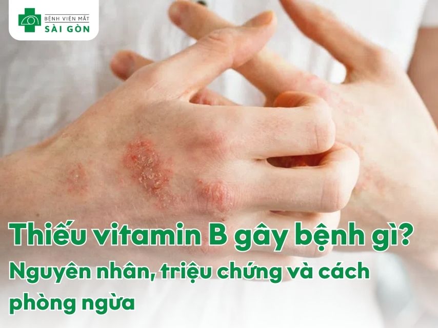 Thiếu vitamin B gây bệnh gì