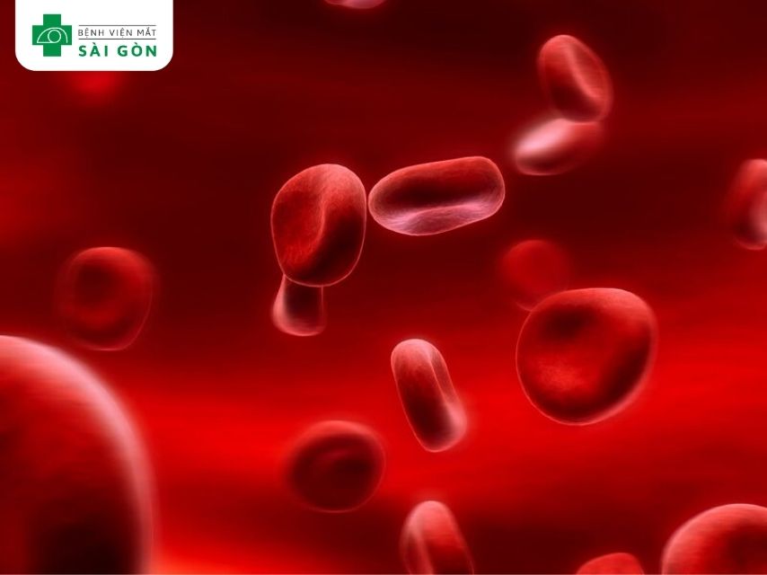 Thiếu vitamin B12 gây bệnh thiếu máu hồng cầu