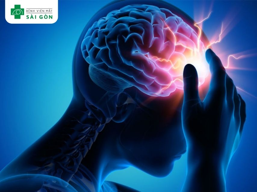 Cơ thể thiếu vitamin B12 gây rối loạn thần kinh