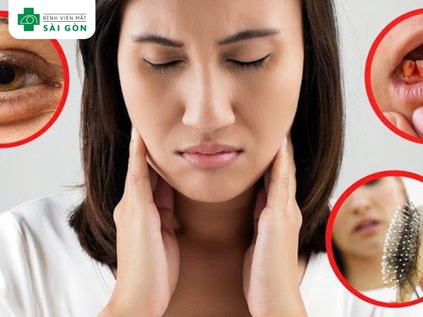 Thiếu vitamin B7 (Biotin)