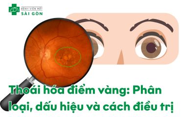 Thoái hóa điểm vàng