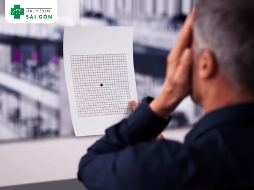 Thoái hóa võng mạc là gì