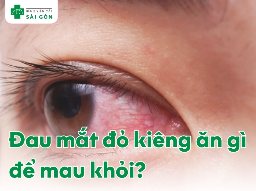 Tìm hiểu các thực phẩm cần tránh khi đau mắt đỏ