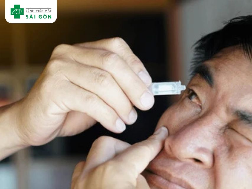 Thuốc nhỏ mắt giả lệ (artificial tears)