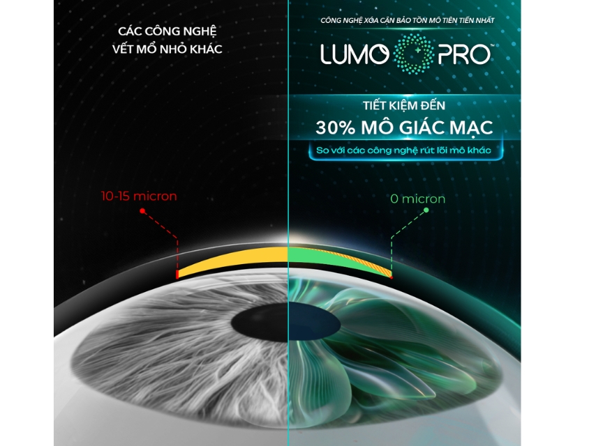 Công nghệ LUMOPRO™ giúp tiết kiệm hơn 30 micron mô giác mạc