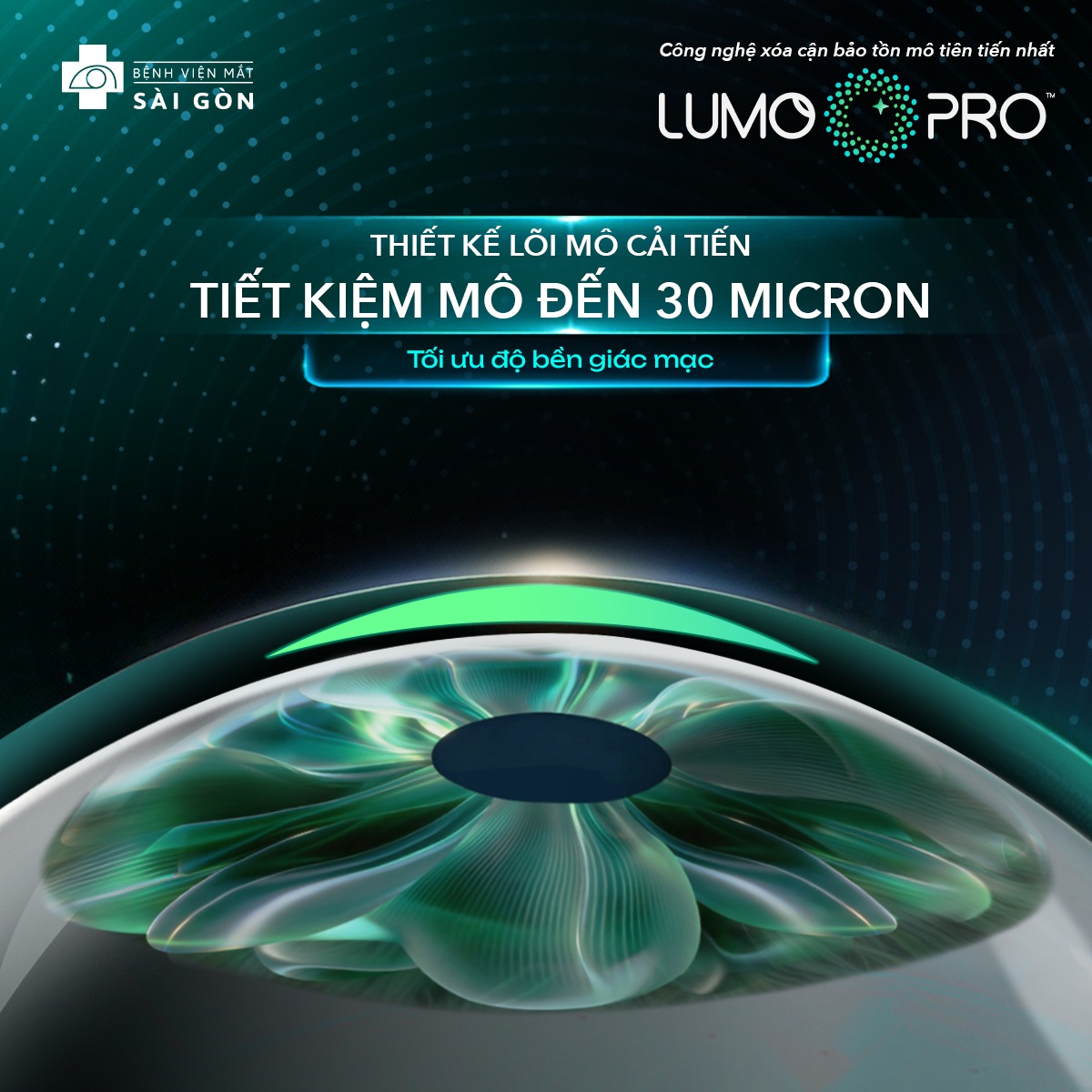 tiết kiệm mô đến 30 micro