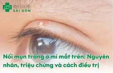 Tình trạng nổi mụn trắng ở mí mắt trên