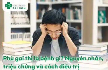 Phù gai thị là bệnh gì
