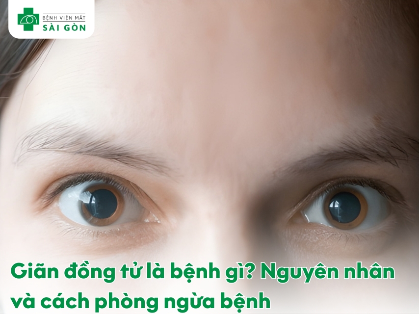 Tìm hiểu về bệnh giãn đồng tử