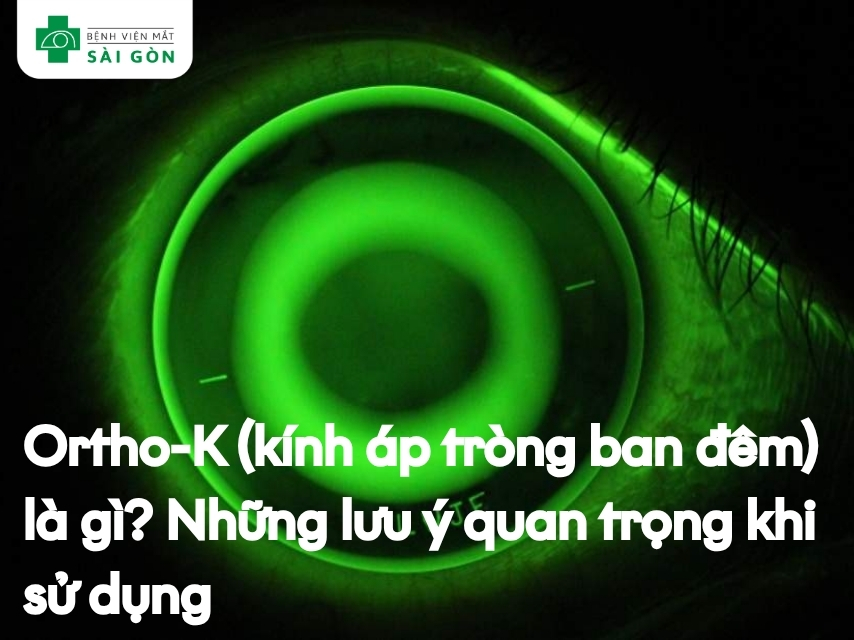 Tổng quan về kính áp tròng ban đêm Ortho K