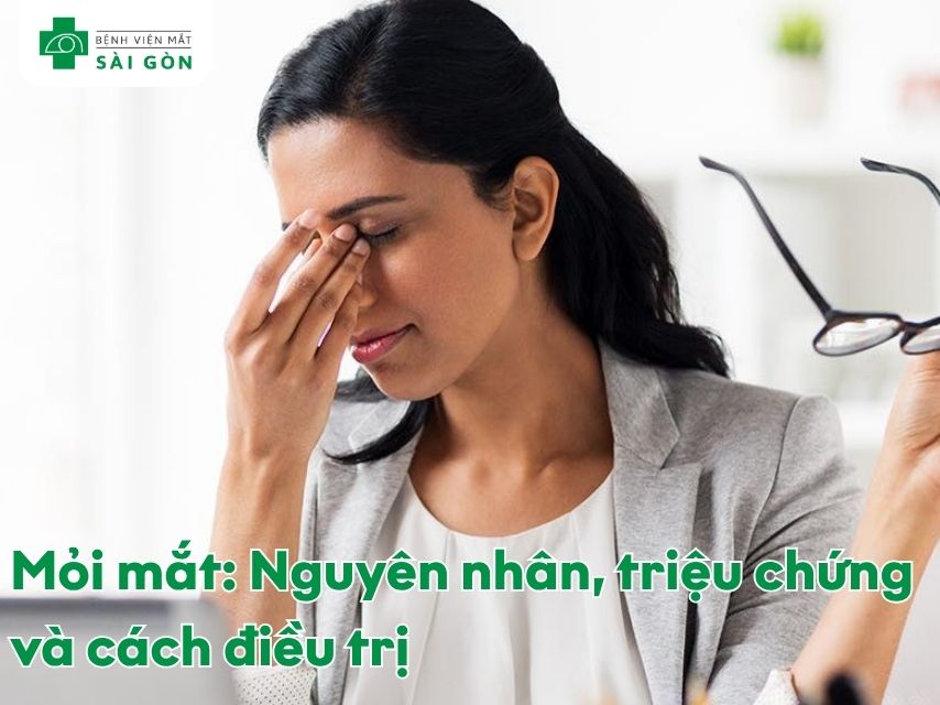 Mỏi mắt (nhức mỏi mắt) là tình trạng cơ mắt bị quá tải, mệt mỏi do làm việc cường độ cao trong thời gian dài