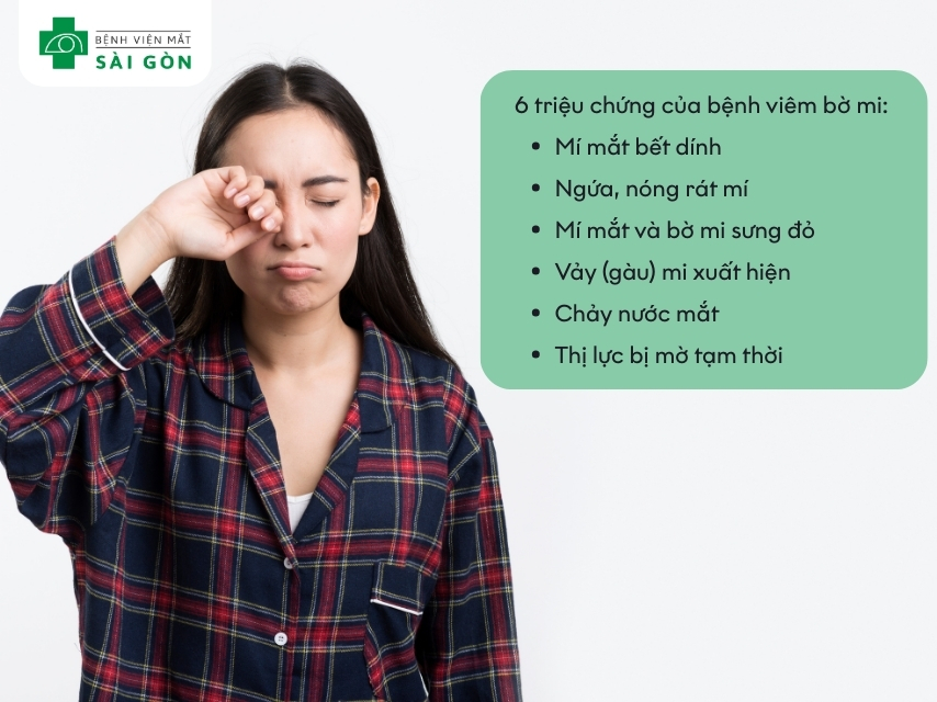 Viêm bờ mi gây nóng, rát mi mắt