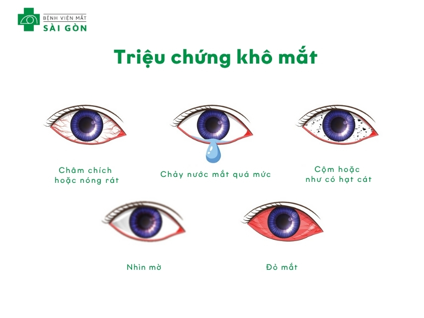 Khô mắt khiến mắt đỏ rát