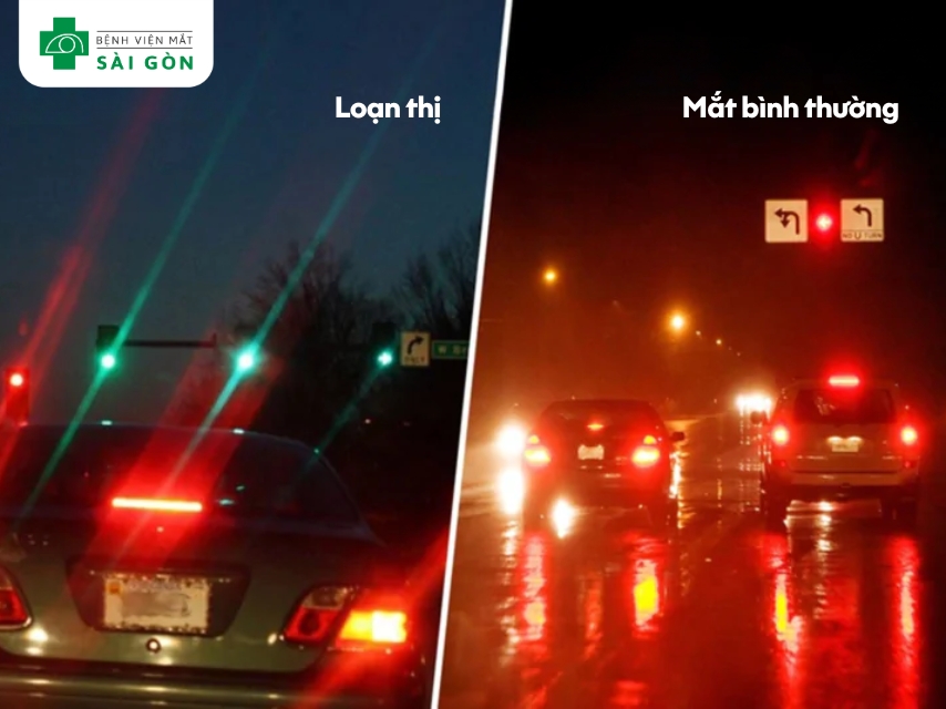 Người mắc loạn thị nhìn mờ