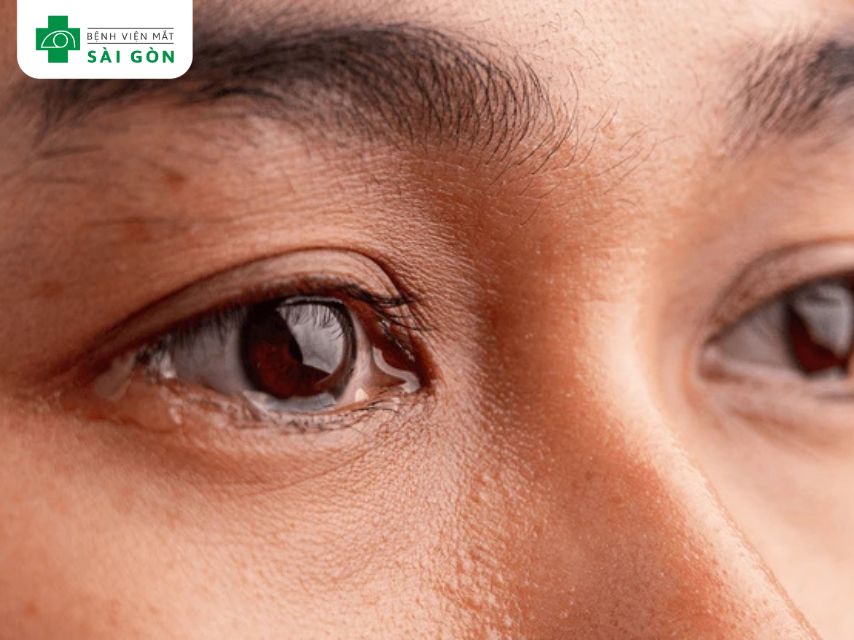 Vai trò của kết mạc