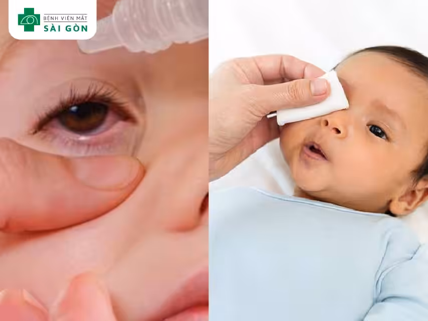 Vệ sinh mắt cho bé