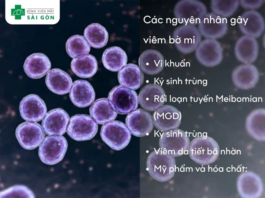 Vi khuẩn Staphylococcus aureus là nguyên nhân phổ biến nhất, gây nhiễm khuẩn ở chân lông mi và kích thích mô xung quanh.