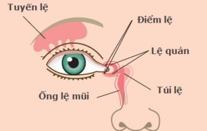 Viêm lệ quản, triệu chứng và cách điều trị Viêm lệ quản