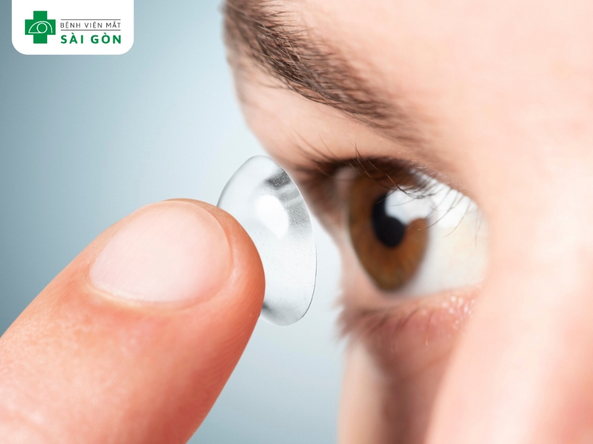 Dị vật hoặc dùng kính áp tròng sai cách có thể gây kích ứng, viêm mắt