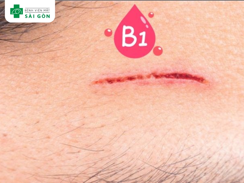 Vitamin B1 hỗ trợ phục hồi vết thương.