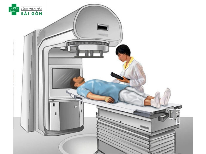Xạ trị điều trị mắt lồi giai đoạn đầu