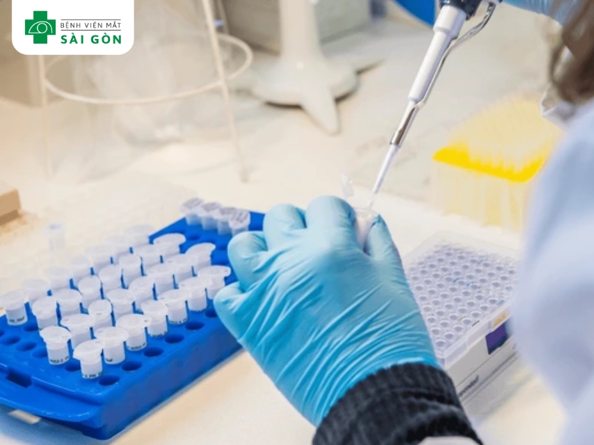 Xác định virus VZV bằng xét nghiệm PCR